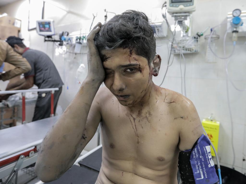 A Palestinian boy injured in Israeli raids arrive at Nasser Medical Hospital. Picture: Getty Images