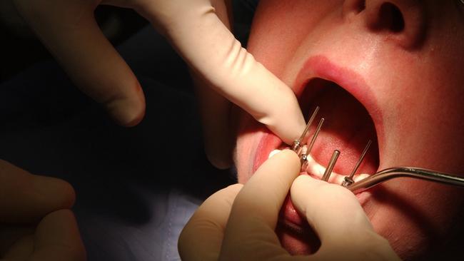 The Andrews Government today signed off on the latest dental funding agreement with Canberra. Picture: AP