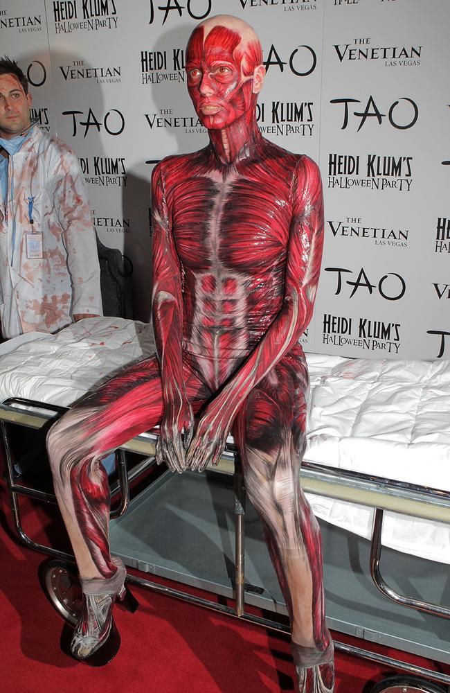 2011: A human body. Picture: Chris Weeks/WireImage