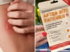 Campers love $8.50 chemist buy that calms mosquito bites