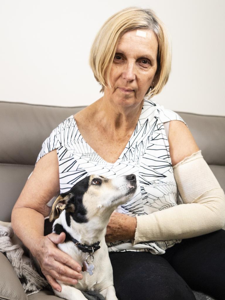 Vyvyan Glover, pictured with Kemba, call on the owner of the dogs who attacked them to come forward before the dangerous dogs attack again, Thursday, August 25, 2022. Picture: Kevin Farmer