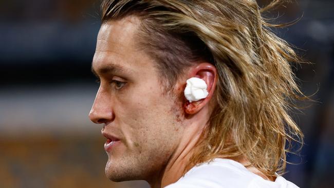 ‘Vertigo symptoms’: Magpies cop Anzac Day injury blow