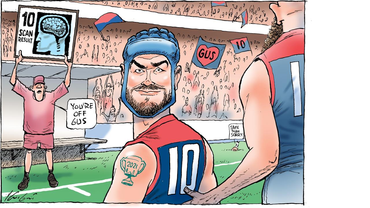 Mark Knight's concussion cartoon offers a fond farewell to star AFL player Angus Brayshaw, after his heartbreaking decision to retire from the sport due to medical advice. Picture: Mark Knight