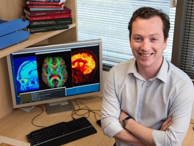 A Monash Study has shown exercise can help to maintain brain health.