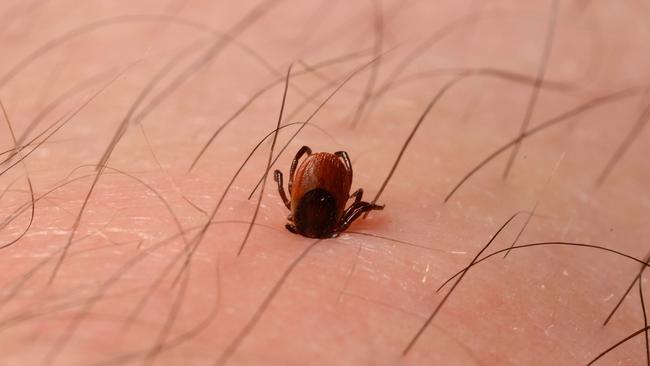 Deer tick embedded in skin of leg. Credit: Ashley Prytherch.