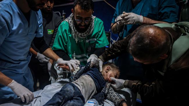 Medics take in charge a wounded child at Kuwait hospital in Rafah. Picture: AFP