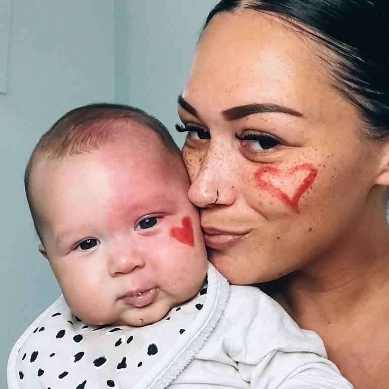 His mum Brooke was trolled after getting the birthmark removed. Picture: Instagram