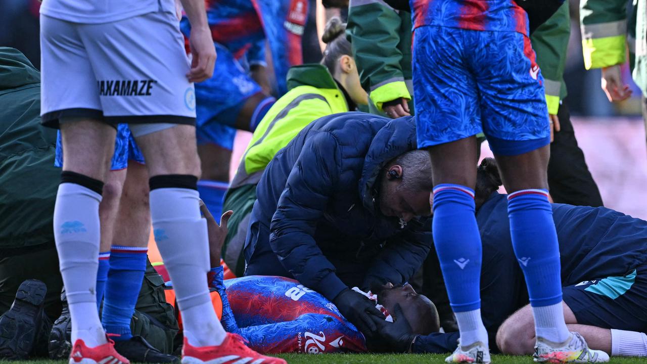 Jean-Philippe Mateta receives medical attention. Photo by Glyn KIRK / AFP.