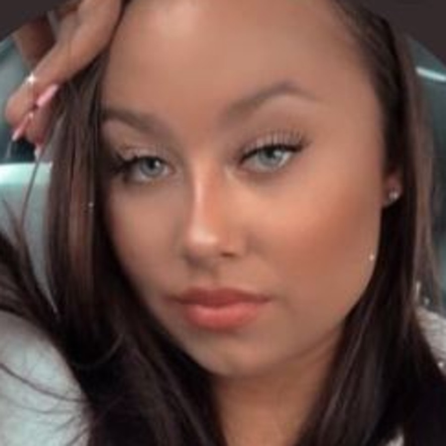 Adara Graham, 19, from the UK claims a zebra-print top she purchased from PrettyLittleThing caused her breasts to ‘burn’. Picture: Twitter/adara_graham21