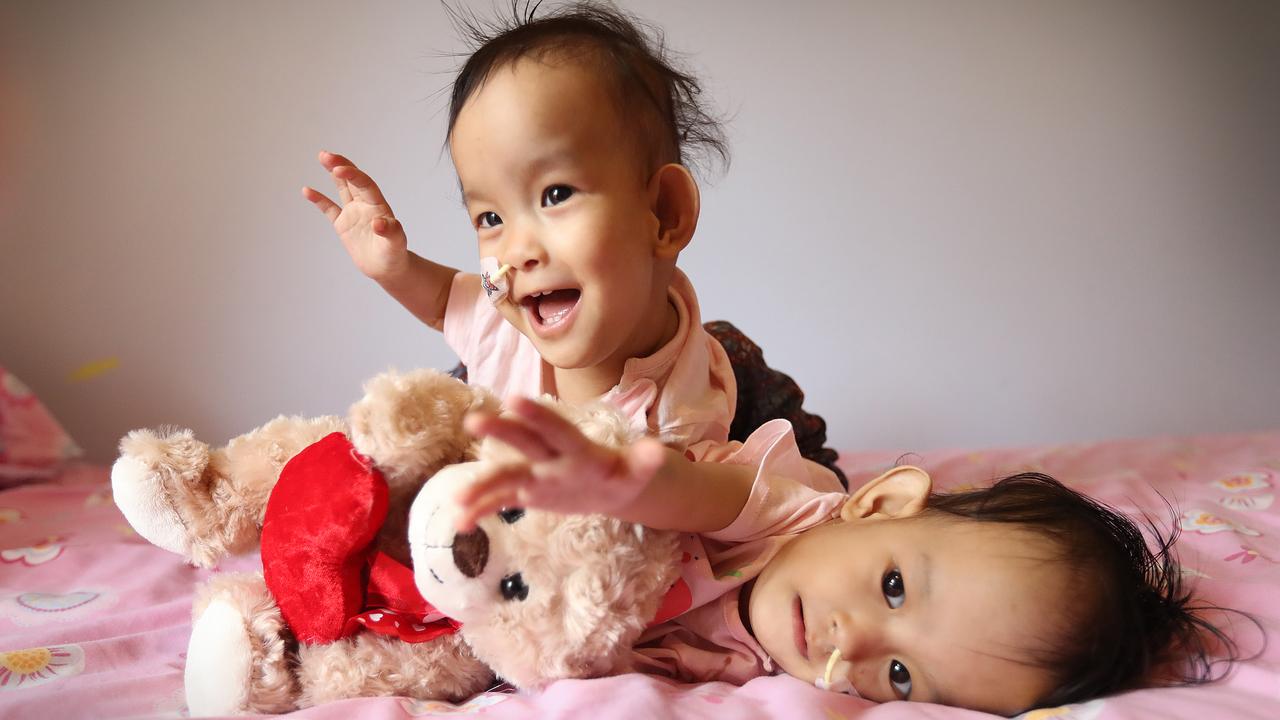 Bhutanese conjoined twins Nima and Dawa relax after returning to the Children First Foundation Miracle Smiles Retreat in Kilmore. Picture: Alex Coppel