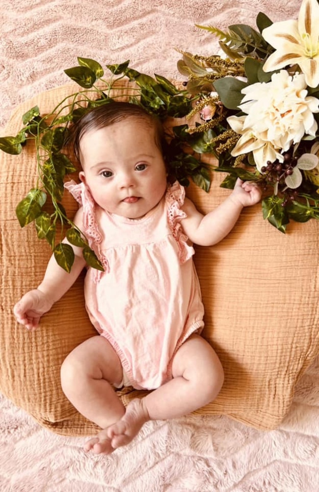 Thea Hall: Born on 27/12/2022 and soon to be one year old, Thea is her mum, Amy Aked's happy & cuddly baby with Down syndrome who bring lots of joy to life.