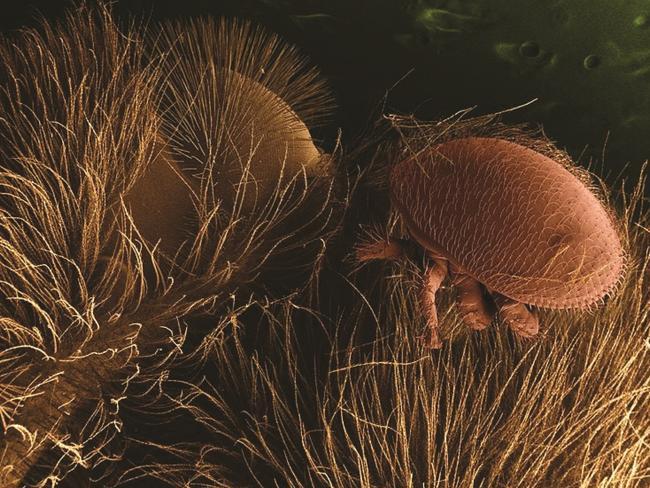 The Varroa mite on a bee pupa. Seven species of Australian bees have no resistance to this mite, which is devastating bee colonies worldwide but has not yet entered Australia. 