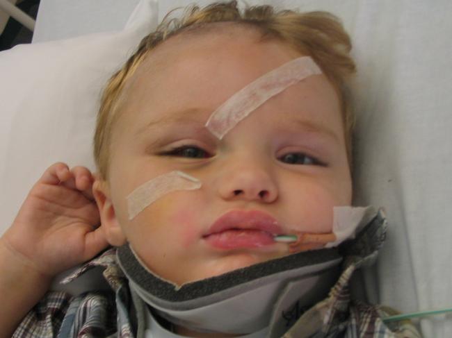 Layton Smith in 2004, then aged 2, recovering in hospital from being hit in a car crash that is in 2016 the subject of a NSW Supreme Court appeal. Picture: Supplied