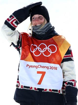 Laurie Blouin with her black eye. Picture: Getty