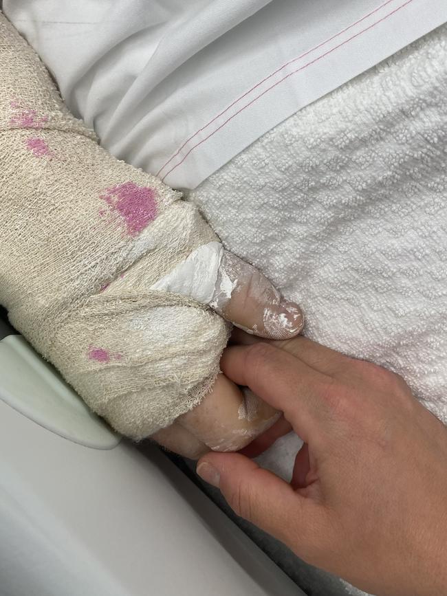 Chase remembers waking up at the crash site and seeing blood everywhere. Picture: Supplied