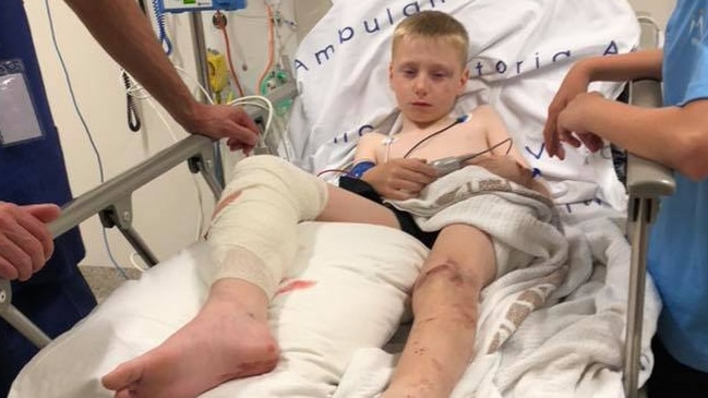 Grade 4 student Charlee Jones suffered serious injuries when he was hit by a Craigieburn school bus at the same intersection. 