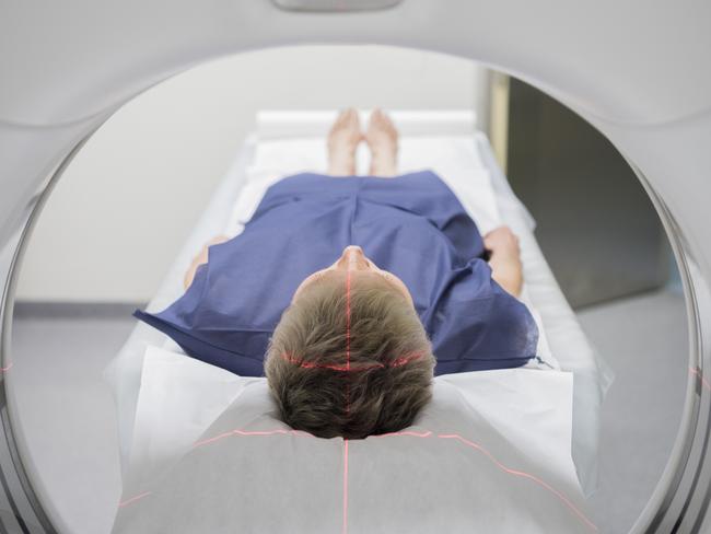 Fairfield mayor Frank Carbone is pushing for MRI scans to be bulk-billed in for residents. Picture: stock image.