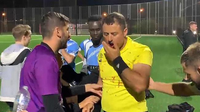 Blood could be see spattered on the referee’s shirt. Picture: Supplied