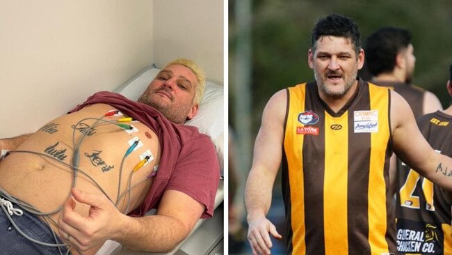 Brendan Fevola in hospital and on the footy field. Photos: Supplied/NewsWire