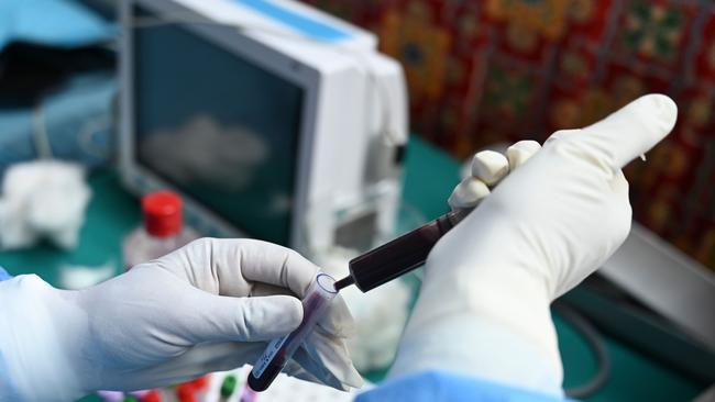 Immunosis have developed a test capable of diagnosing PIDs from a blood sample. Picture: AFP