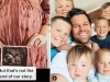 Mum-of-seven has Pregnancy Loss Syndrome