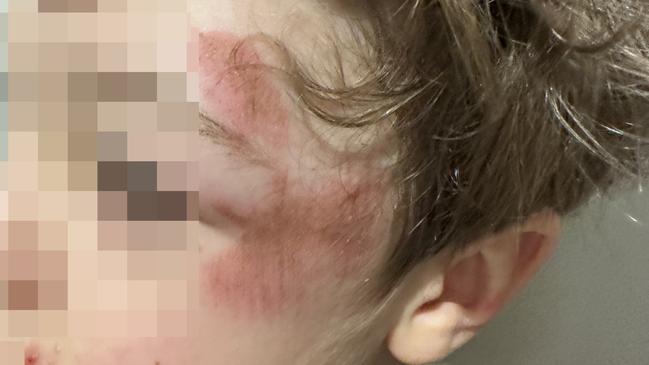 Students at an Ormond special school are attacking each other in the schoolyard after being left unsupervised. Picture: Supplied