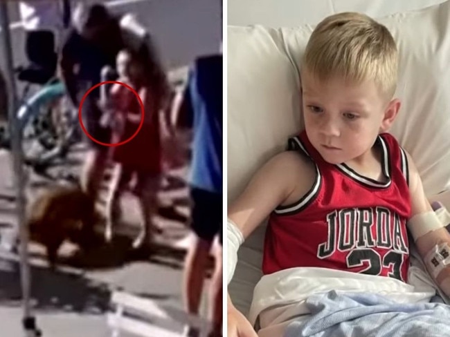 A six-year-old boy has relived the moment an English Bulldog 'ripped' his arm in a brutal attack at a Gold Coast cafe