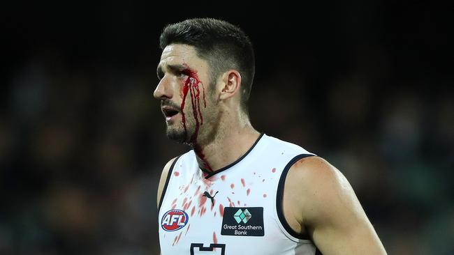 Marc Pittonet of the Blues suffered an eye injury. (Photo by Sarah Reed/AFL Photos via Getty Images)