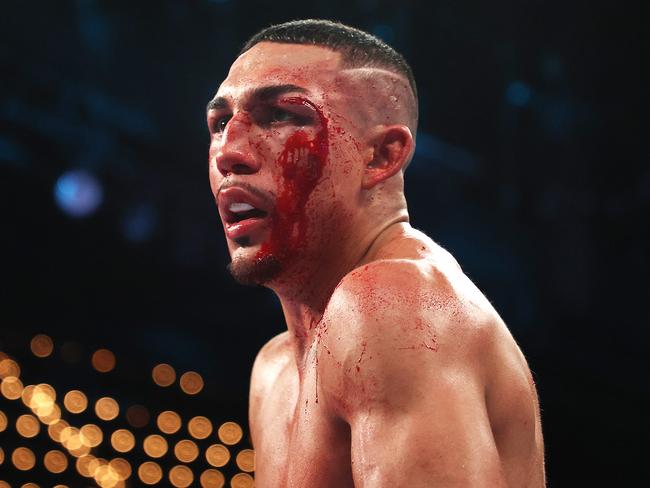 NEW YORK, NEW YORK - NOVEMBER 27:  Teofimo Lopez stands bloodied during his bout against George Kambosos for Lopezâs Undisputed Lightweight title at The Hulu Theater at Madison Square Garden on November 27, 2021 in New York, New York. (Photo by Al Bello/Getty Images)