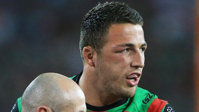 Burgess with his fractured cheekbone suffered in the 2014 grand final. Picture: Mark Evans