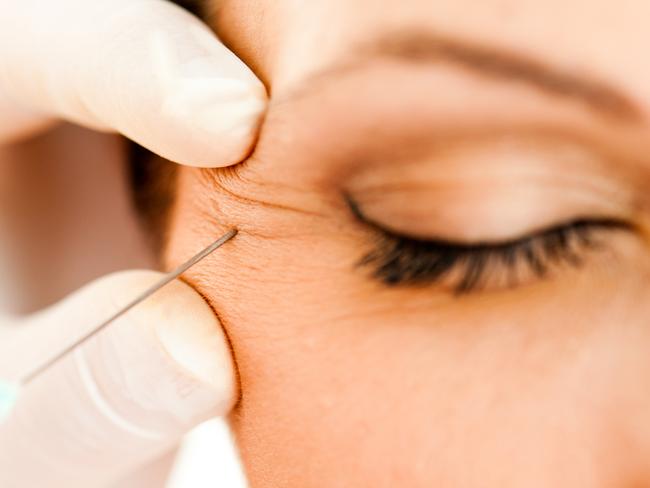 Closeup of botox injection in wrinkle near eye