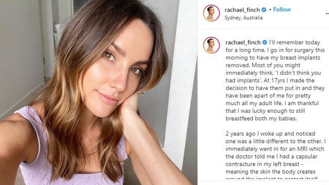 Queensland model and former Channel 7 sports reporter Rachael Finch has told of her two-year struggle with her own breast implants.