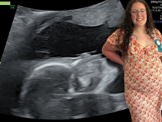 imogen thumbnail for her pregnancy diary