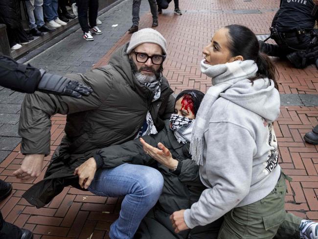 Demonstrators help a bloodied pro-Palestinian protester near Dam Square during a Pro-Palestinian protest in Amsterdam on November 10, 2024. The protest is taking place while an emergency ordinance and demonstration ban are in place in the city. These were previously deployed following tensions and violence surrounding supporters of Israeli football club Maccabi Tel Aviv. (Photo by Robin van Lonkhuijsen / ANP / AFP) / Netherlands OUT