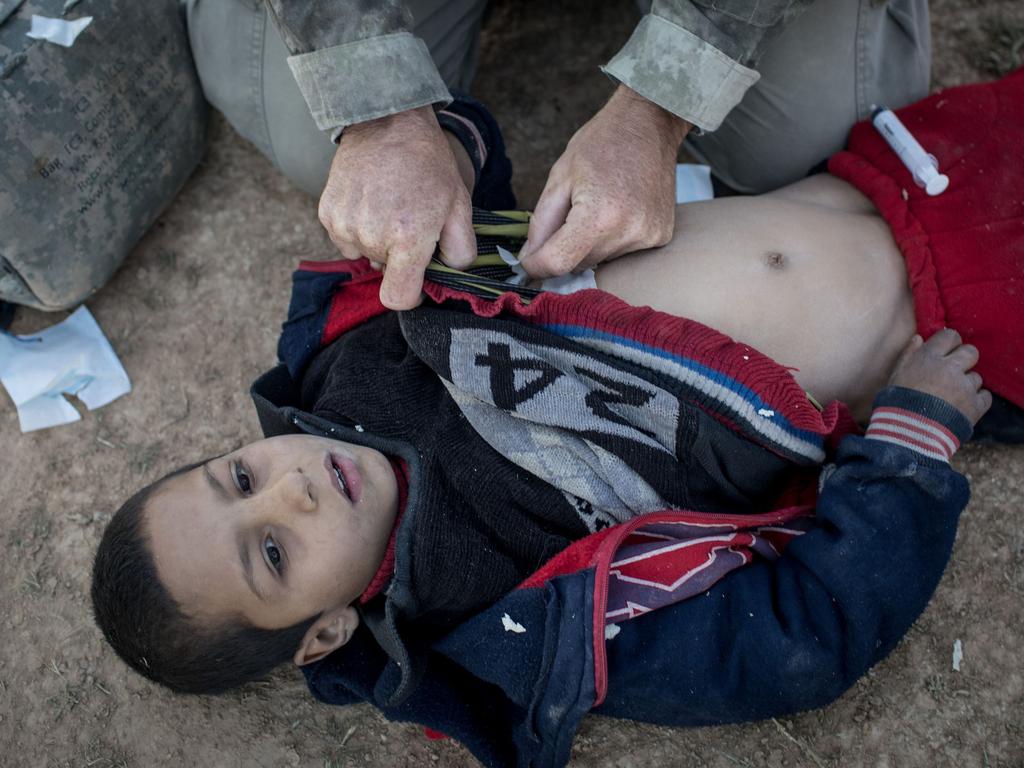 A young boy receives medical treatment for a gunshot wound in Baghouz, Syria. Civilians fleeing fighting have increased during the final operation to oust ISIS. Picture: Getty Images