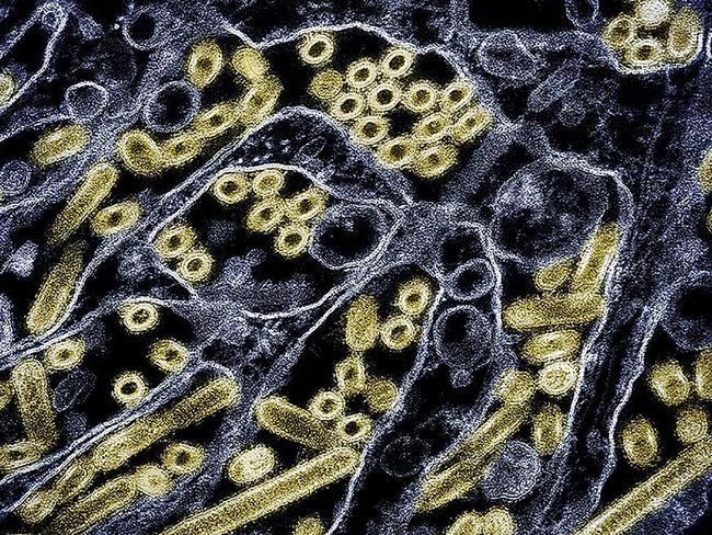 Micrograph of Influenza A. Picture: CDC and NIAID / AFP