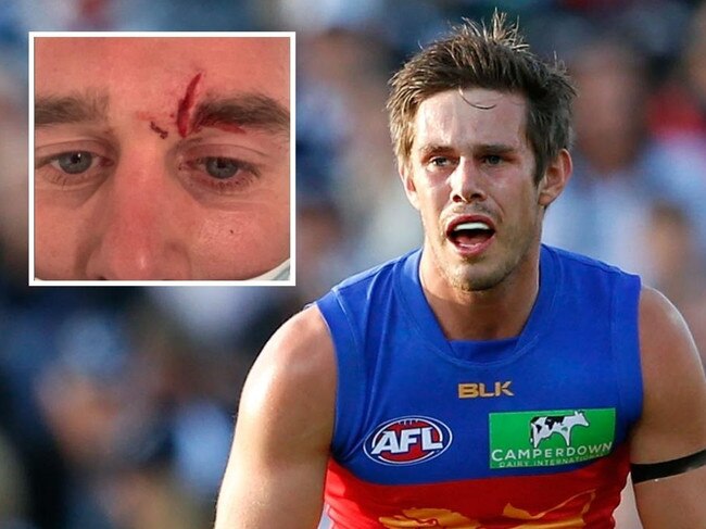 Ex-AFL star slams local footy ‘cowards’