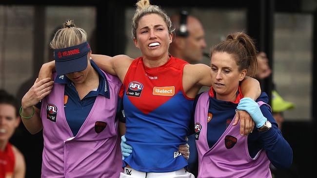 Hickey tore her ACL last season while playing for Melbourne. Picture: Getty