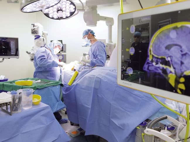 Supplied undated image obtained Wednesday, August 30, 2017 of medical professionals performing neurosurgery at the Ramsay Health Care-operated Greenslopes Private Hospital in Brisbane. Ramsay Health Care has lifted full-year net profit 8.6 per cent to $488.9 million on the back of growth in admissions and procedural volumes across the company's Australian business. The country's largest private hospital operator said revenue from services for the year to June 30 grew marginally, up 0.2 per cent, to $8.7 billion, from $8.68 billion a year ago. (Ramsay Health Care)  EDITORIAL USE ONLY