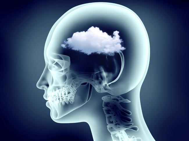 x-ray image of human head with cloud