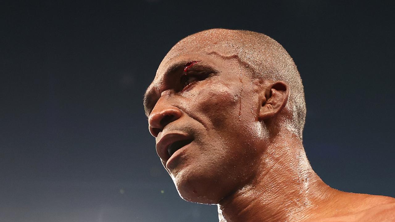 NEWCASTLE, AUSTRALIA - MARCH 31: Sakio Bika is seen with a cut above his eye during his Catchweight fight against Sam Soliman at Newcastle Entertainment Centre on March 31, 2021 in Newcastle, Australia. (Photo by Cameron Spencer/Getty Images)