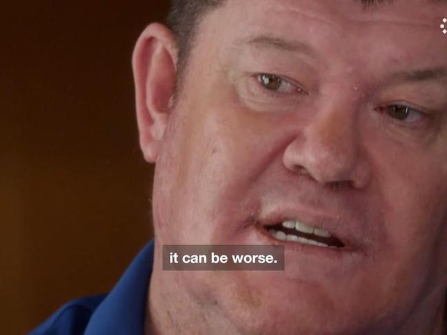 James Packer opens up on mental health struggles