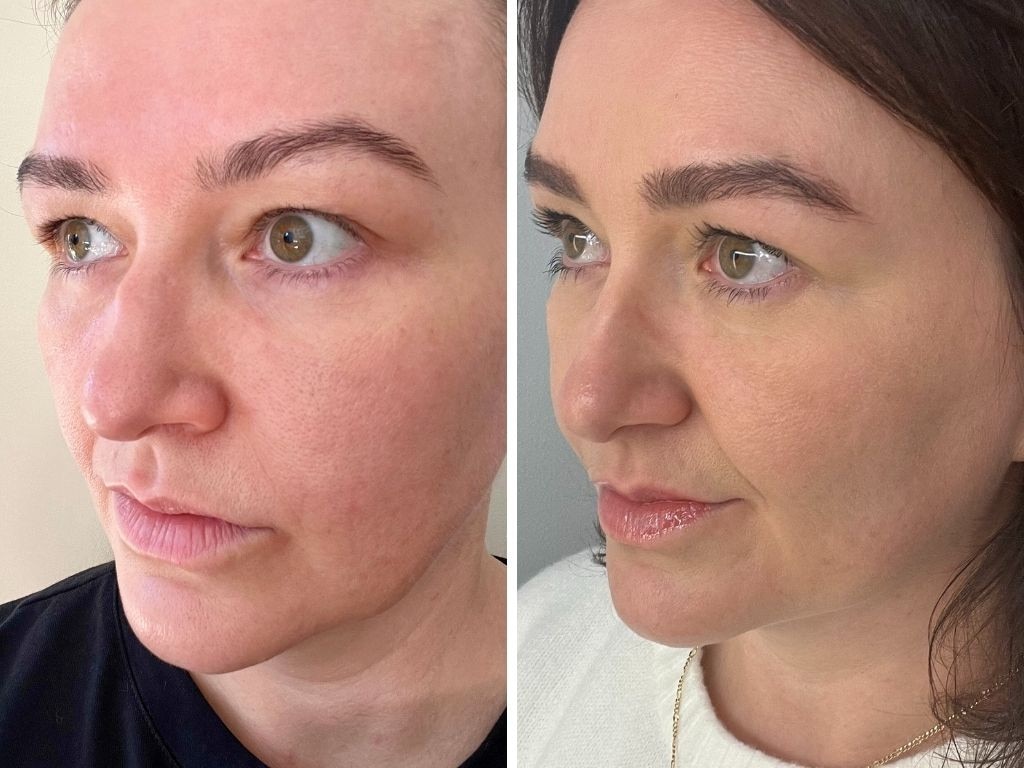 I was actually amazed at how this $28 roll-on oil delivered visible growth to my stumpy lashes and thinned out brows within a matter of weeks. Picture: Kara Byers/news.com.au