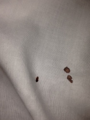 Mr Rose said he found bed bugs in both rooms he stayed in. Picture: Patrick Rose/Shine Lawyers