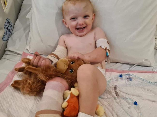 Leon Hobby, nearly two, needed a foot amputation and a blood transfusion after a freak mowing accident in Gympie on April 24.Â Picture: Supplied.