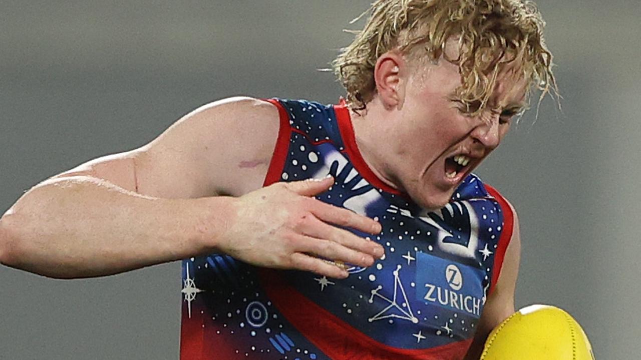 Clayton Oliver reacts after he was kicked in the hand during Friday night’s defeat.