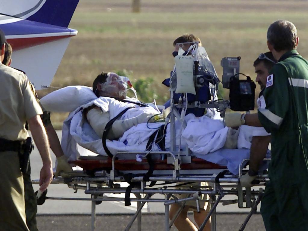 A victim arrives in Darwin to receive treatment for burns and shrapnel injuries sustained after falling victim to the Sari Nightclub bombings blast. Picture: Darren Seiler.