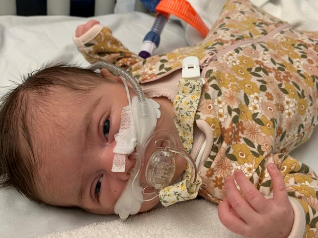 Toowoomba toddler Annabelle Peacock was diagnosed with  laryngomalacia at three weeks old, that caused soft tissue to fall over and block her airway.