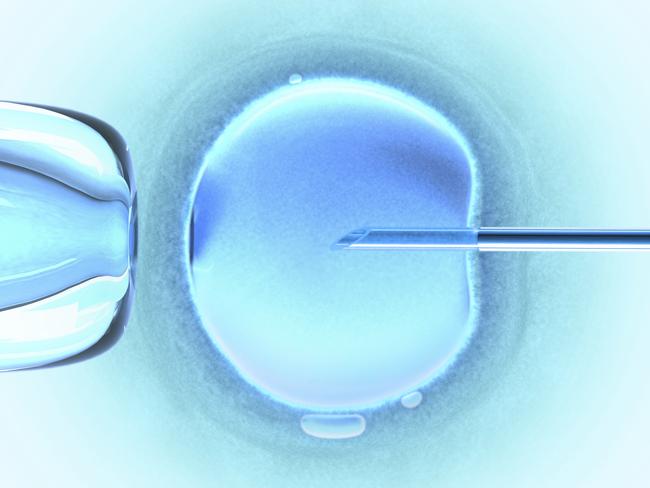 Generic image of an IVF needle in female egg.