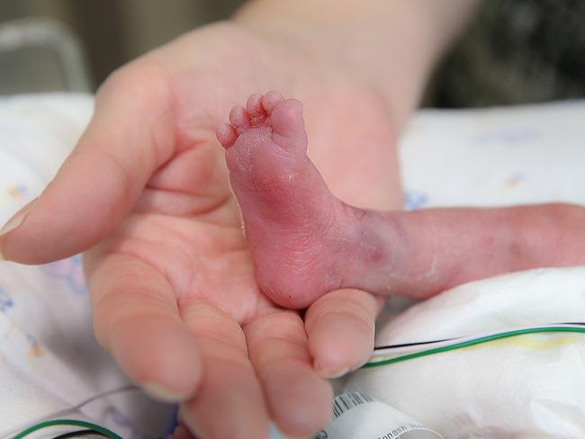 Hudson Institute researchers are testing whether a supplement favoured by gym junkies can help prevent the brain damage often suffered as a result of being born premature.Felicity Leddin with her premature baby Ethan now 7 weeks old. Picture : Ian Currie